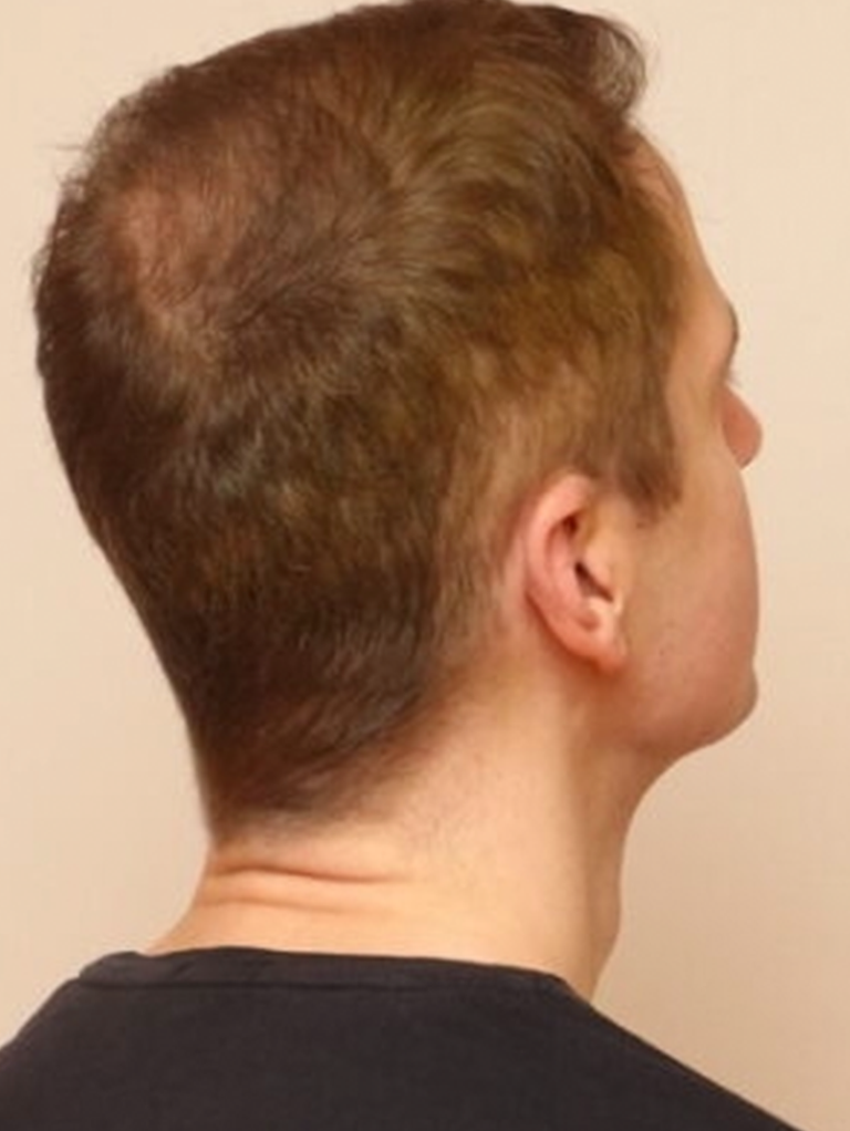 Bild von Model mit Khadi Dunkelblond Haarfarbe (Daniel)