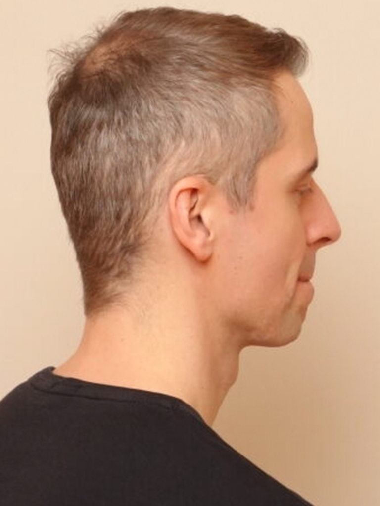 Bild von Model mit Khadi Dunkelblond Haarfarbe (Daniel)